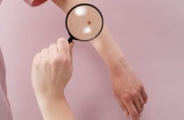 Lietuvos mokslininkų sukurtas naujas neinvazinis metodas gali nustatyti melanomą didesniu nei 90 proc. tikslumu